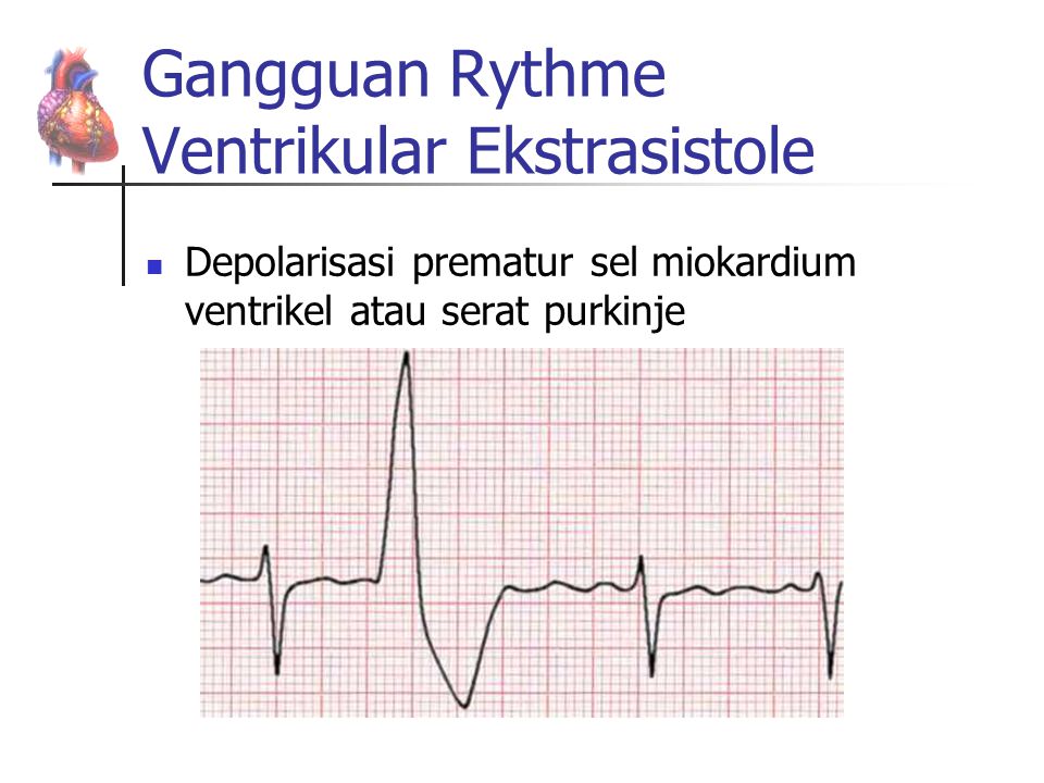 Monitoring EKG Oleh : Emil Huriani. - ppt download