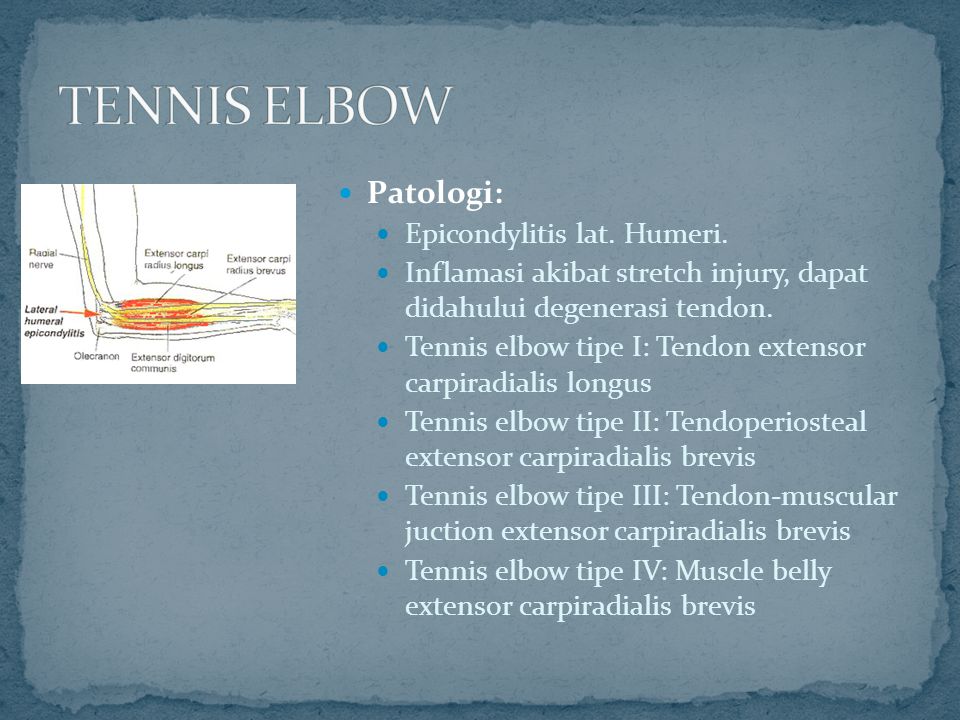 TENNIS ELBOW Patologi: Epicondylitis lat. Humeri.