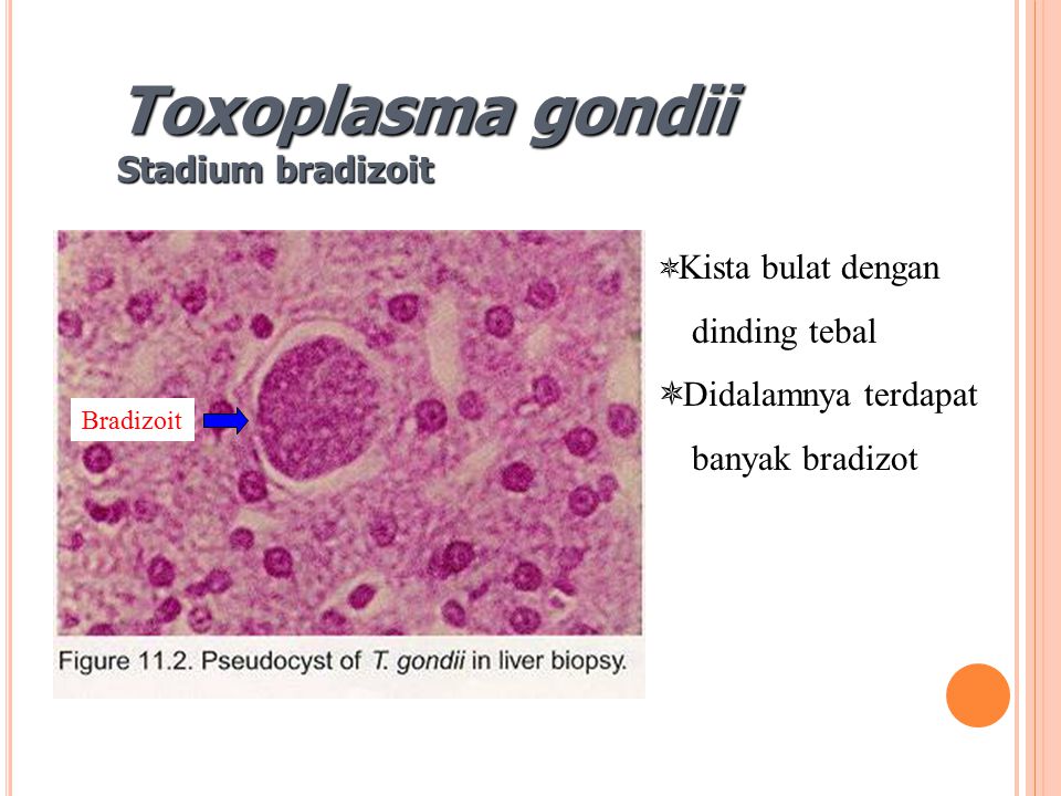 toxoplazma ciszta