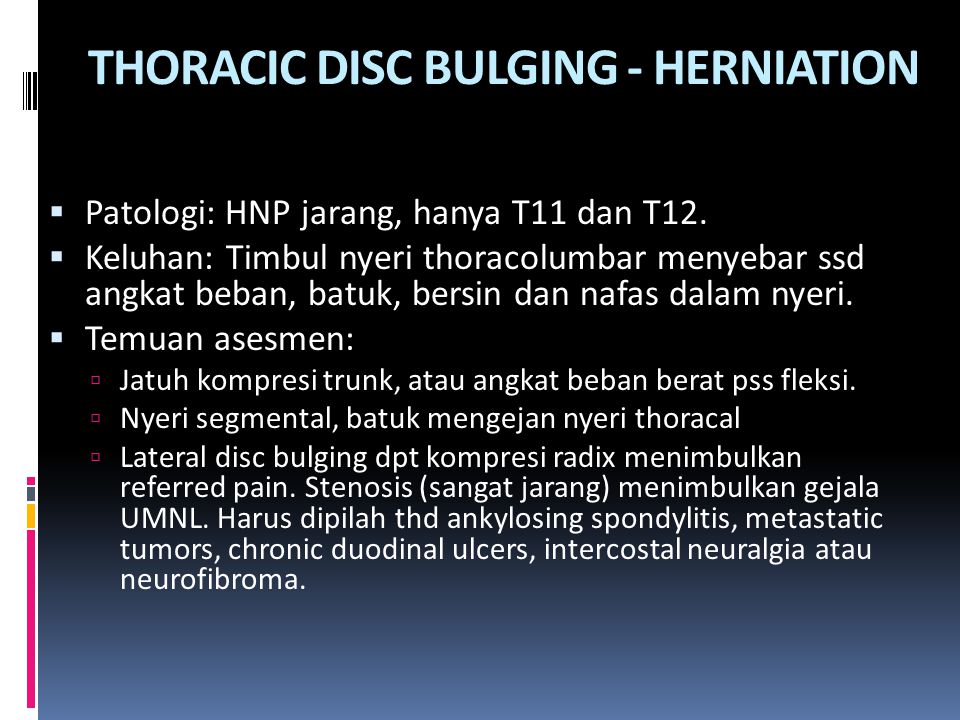 THORACIC DISC BULGING - HERNIATION