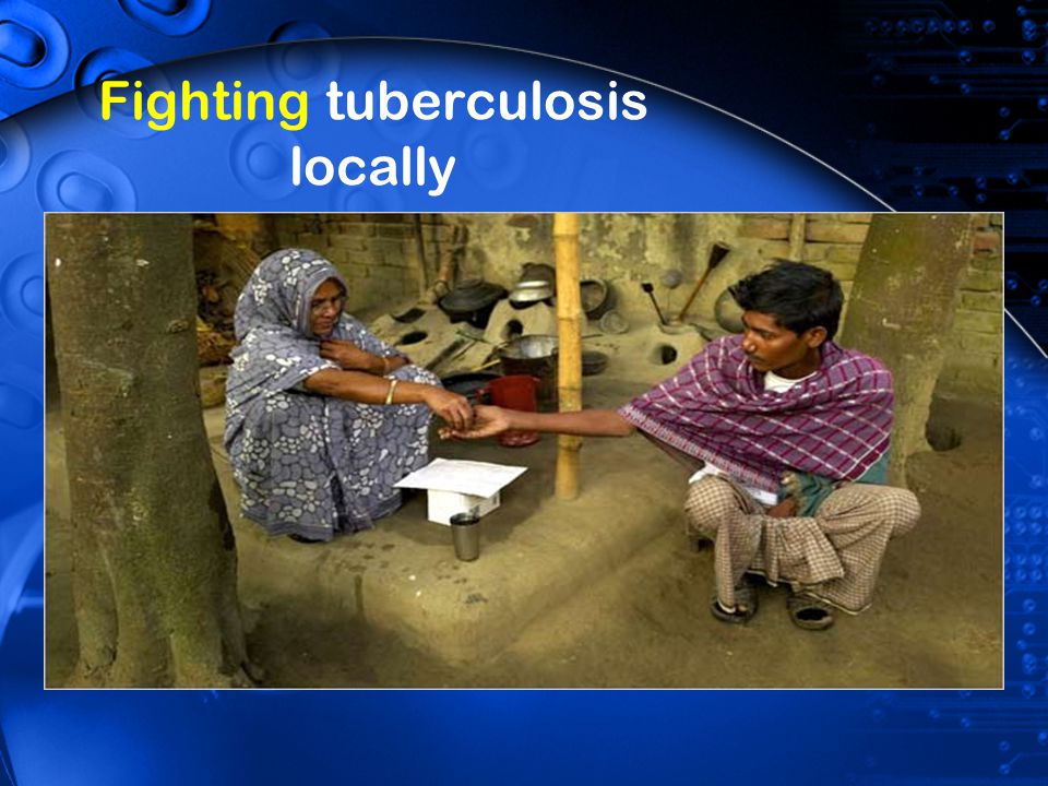 Fighting tuberculosis locally