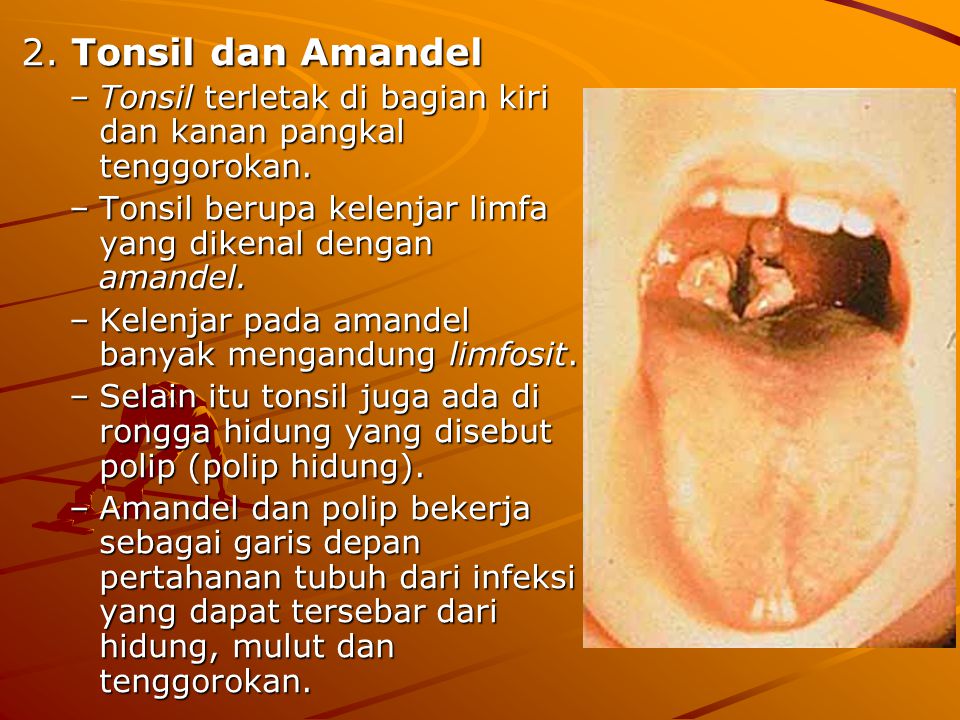 2. Tonsil dan Amandel Tonsil terletak di bagian kiri dan kanan pangkal tenggorokan. Tonsil berupa kelenjar limfa yang dikenal dengan amandel.