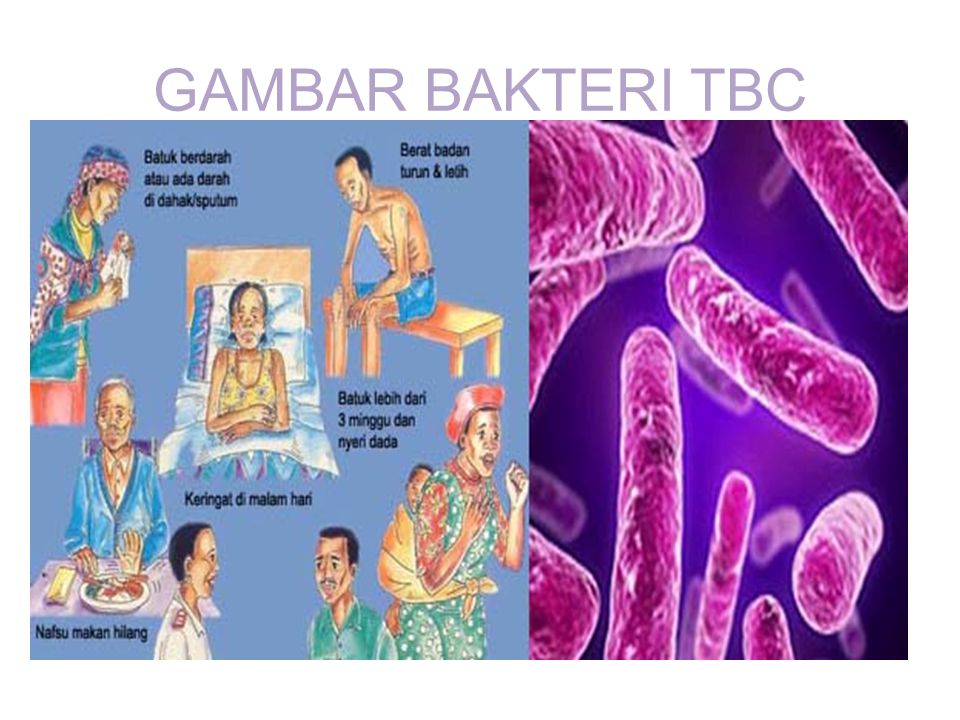 GAMBAR BAKTERI TBC
