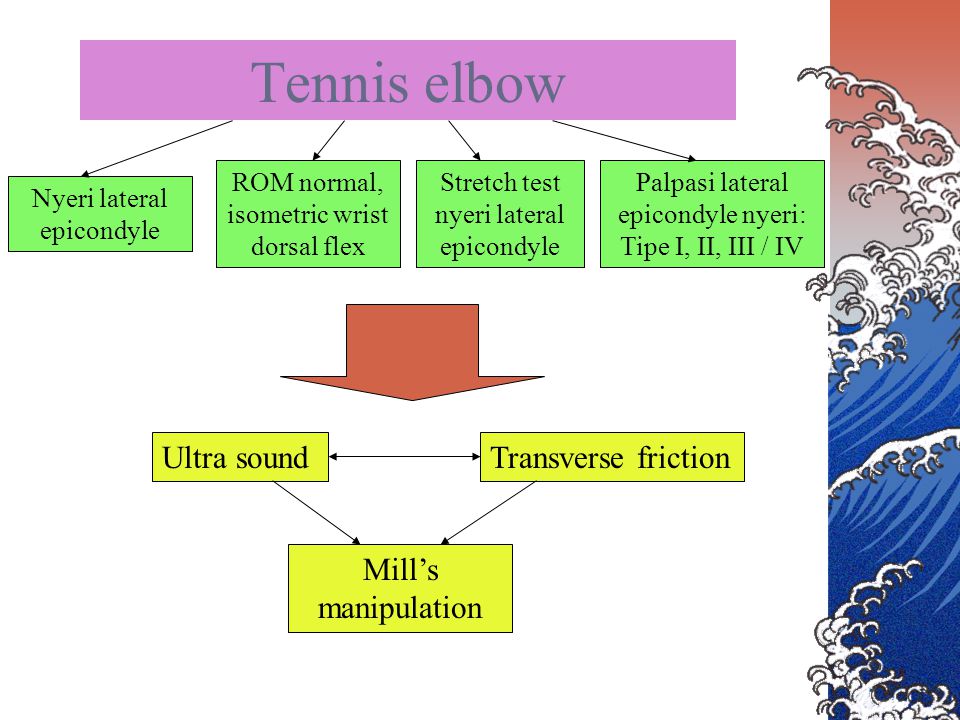 Tennis elbow Ultra sound Transverse friction Mill’s manipulation