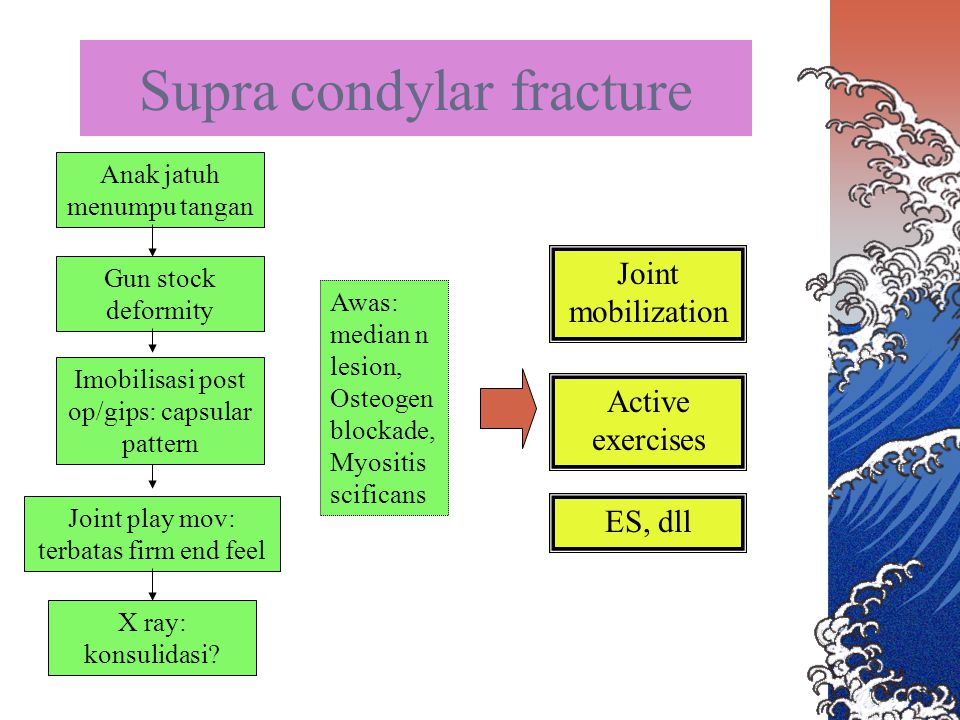 Supra condylar fracture