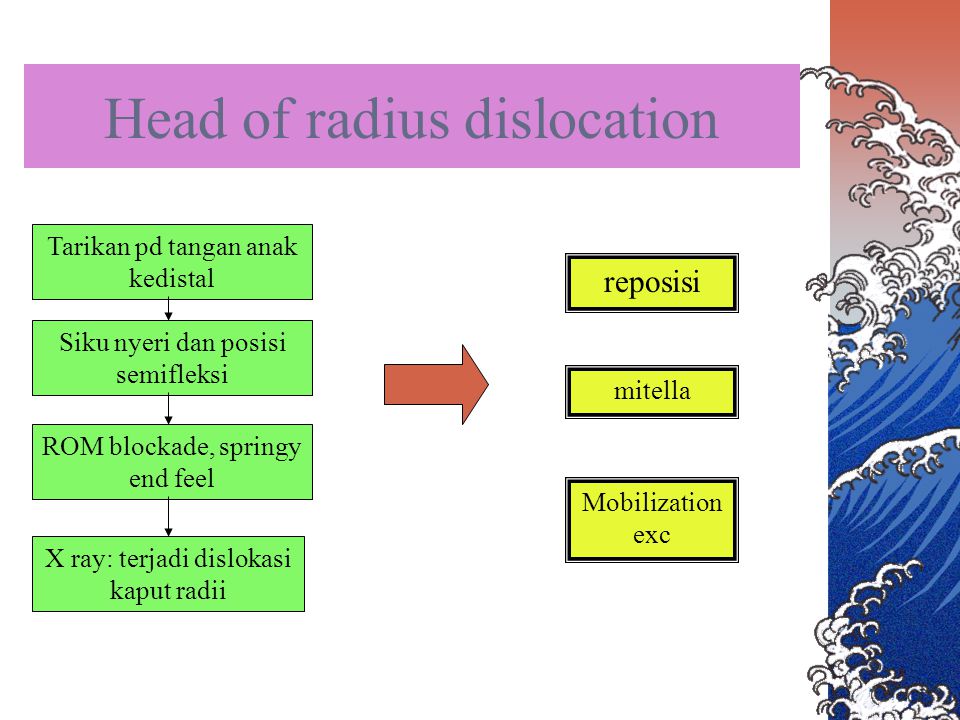 Head of radius dislocation