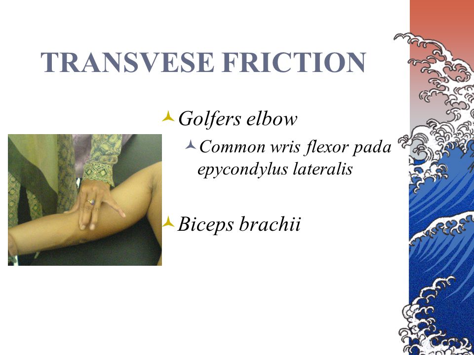 TRANSVESE FRICTION Golfers elbow Biceps brachii