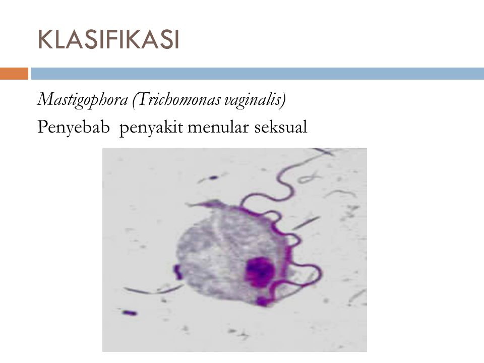 KLASIFIKASI Mastigophora (Trichomonas vaginalis) Penyebab penyakit menular seksual