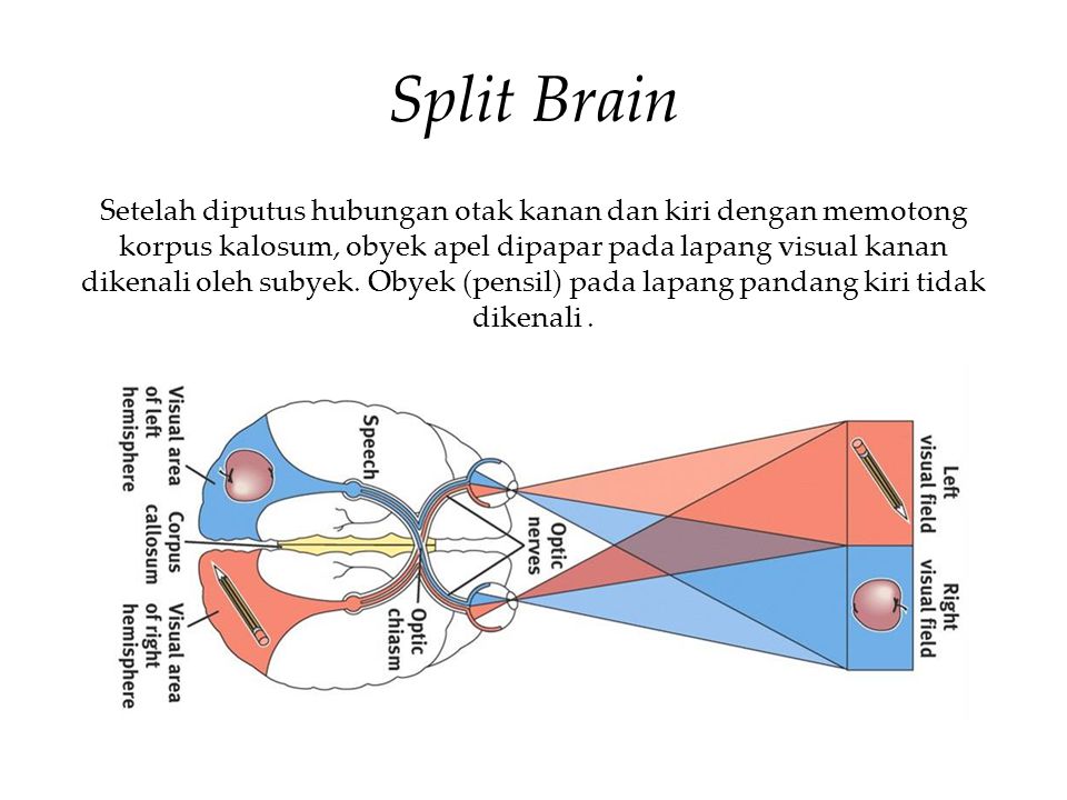 Split brain. Split-Brain DNS.