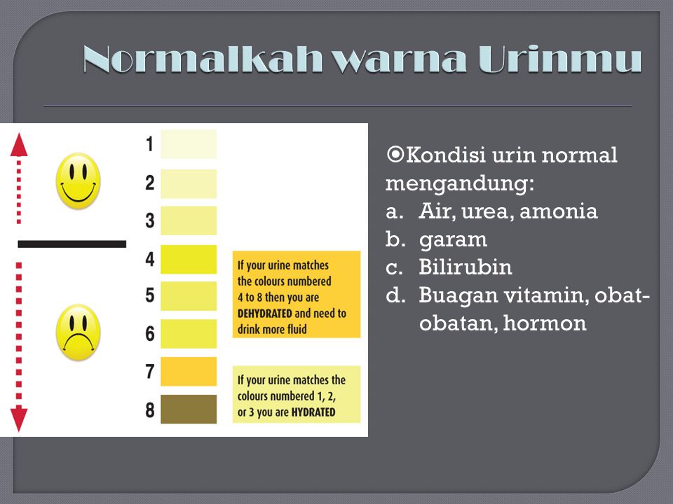 Normalkah warna Urinmu